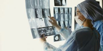 السرطان ما الذي يمكن فعله أيضًا؟