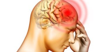 الصداع النصفي الصداع القوي ما الذي يمكن فعله أيضًا؟