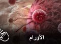 تعانون من مرض السرطان؟ لاداعي لليأس.