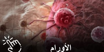 تعانون من مرض السرطان؟ لاداعي لليأس.