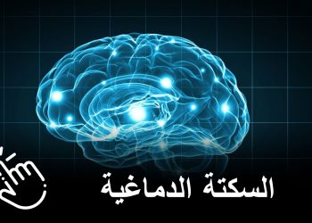 جلطة دماغية