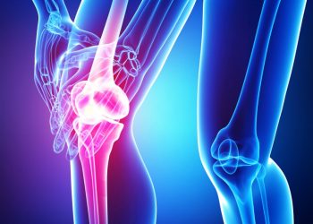 يحكي الناس عن نجاح مذهل في العلاج