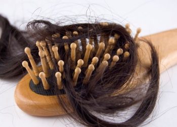 تساقط الشعر