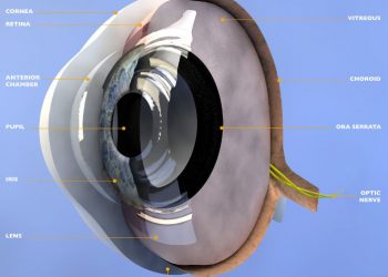 تشير أعراض العين إلى المشاكل التي تنشأ عندما ينسكب داخل العين المملوء بالسوائل (الخلط الزجاجي) ثم يعود إلى العين من خلال عملية تسمى الانسداد.