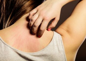 أعراض الأمراض الجلدية التي يجب أن تعرفها تشمل أعراض الأمراض الجلدية أنواعًا عديدة من المشاكل التي يمكن أن تحدث في الجلد والشعر والأظافر.